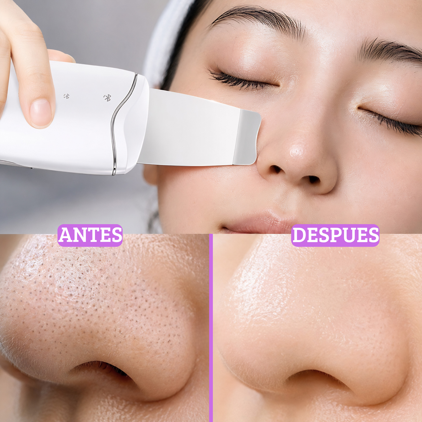 Limpiador facial ultrasonico