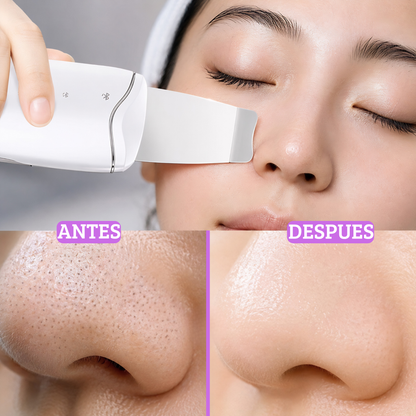 Limpiador facial ultrasonico